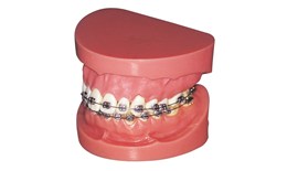 Metal Brackets and Tubes Are Wires