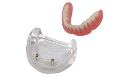 DEDEN-006 Implant Overdentures-Zest Abutments