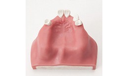 DEIMP-006 Implant Sinus Lifting Practice Model