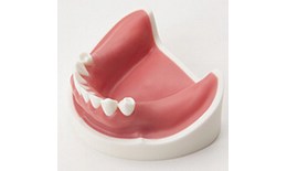 DEIMP-007 Implant Lower Basic Training Model With gingivae