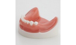 IMP-018-UL Implant Lower Basic Training Model With gingivae