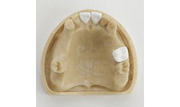 IMP-027-31 Implant Practice Model with Embedding Holes