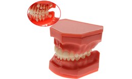 Malocculusion Models
