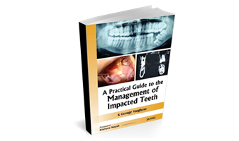 A Practical Guide to the Management of Impacted Teeth