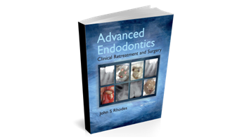 Advanced Endodontics - Clinical Retreatment and Surgery