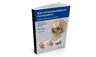 Atlas of Craniomaxillofacial Osteosynthesis