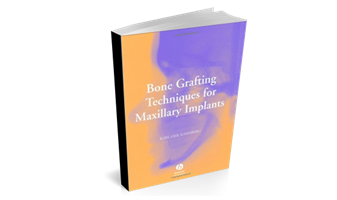 Bone Grafting Techniques for Maxillary Implants