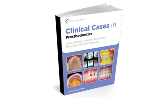 Clinical Cases in Prosthodontics