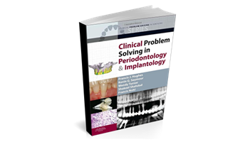 Clinical Problem Solving in Periodontology and Implantology