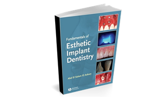Fundamentals of Esthetic Implant Dentistry