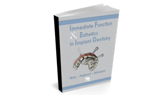 Immediate Function and Esthetic in Implant Dentistry