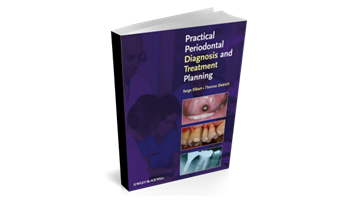 Practical Periodontal Diagnosis and Treatment Planning