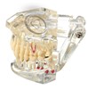 Mẫu hàm tư vấn bệnh lý 5 in 1