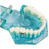 Mẫu hàm tư vấn bệnh lý 5 in 1