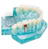 Mẫu hàm tư vấn bệnh lý 5 in 1