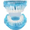 Mẫu hàm tư vấn chỉnh nha mắc cài sứ