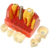 Mô hình tư vấn Implant và cầu răng